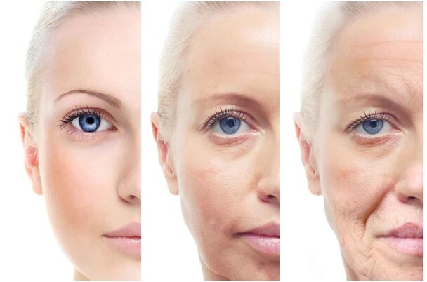 Eliminación láser de los cambios faciales relacionados con la edad