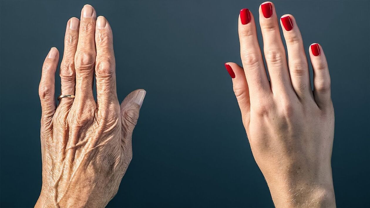 formas efectivas de rejuvenecer la piel de las manos