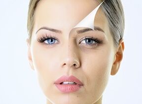 Cómo rejuvenecer la piel alrededor de los ojos en casa.